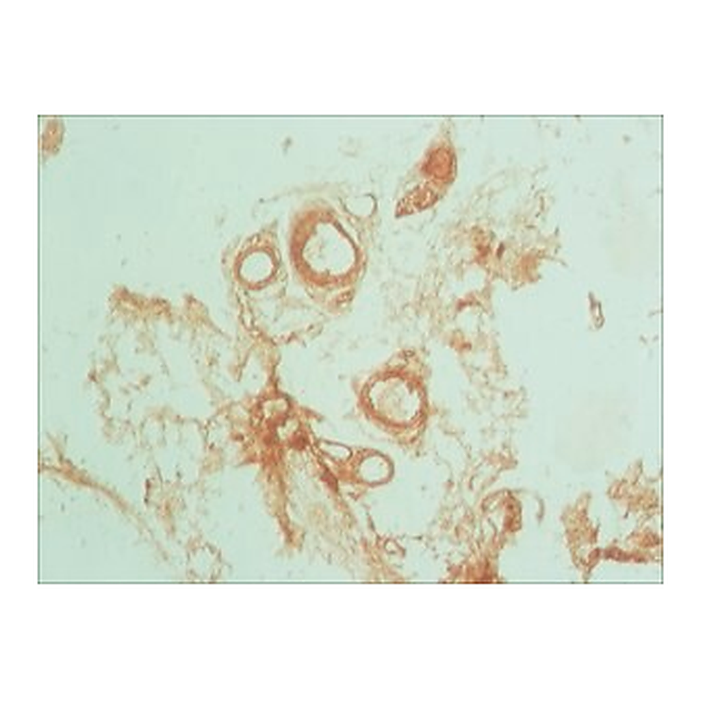 Merck ANTI-PODOPLANIN