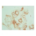 Merck ANTI-PODOPLANIN