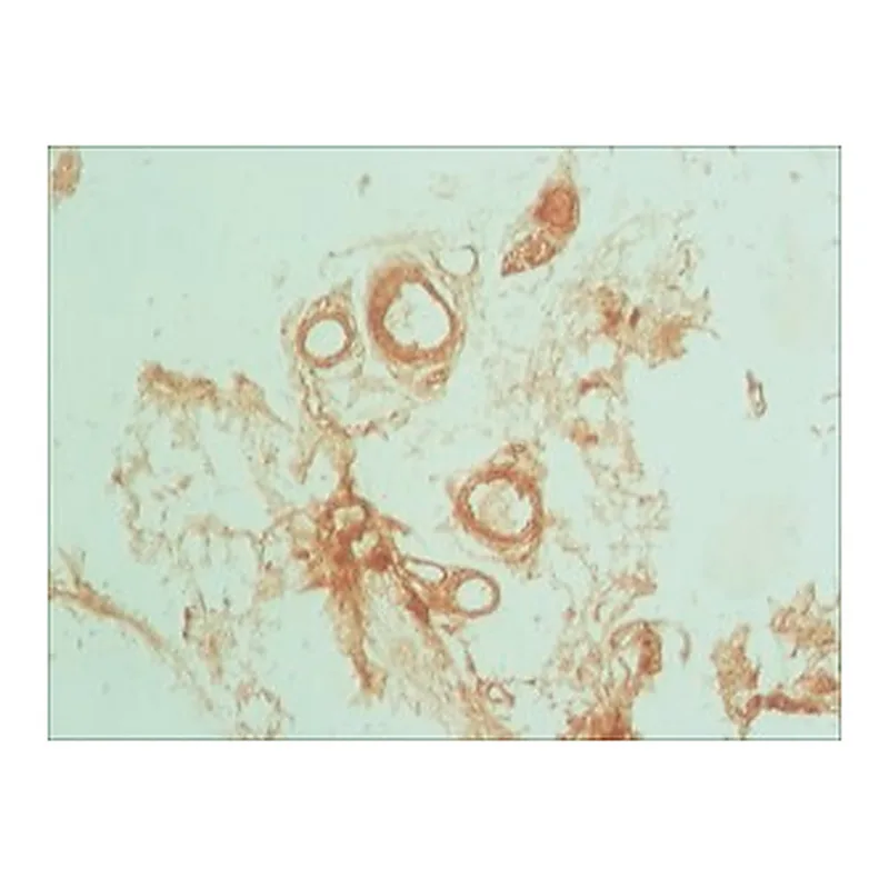 Merck ANTI-PODOPLANIN