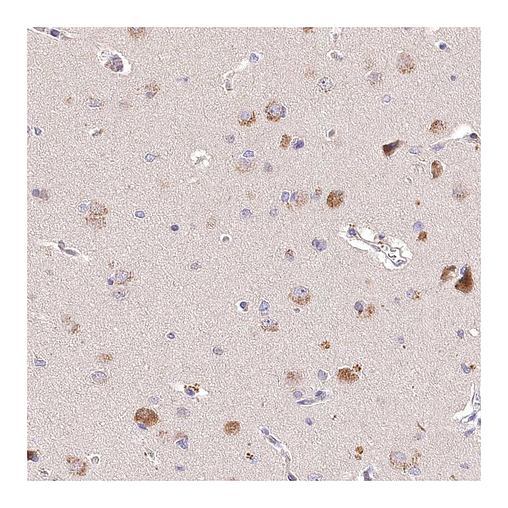 Atlas Antibodies Anti-PCYOX1L Antibody