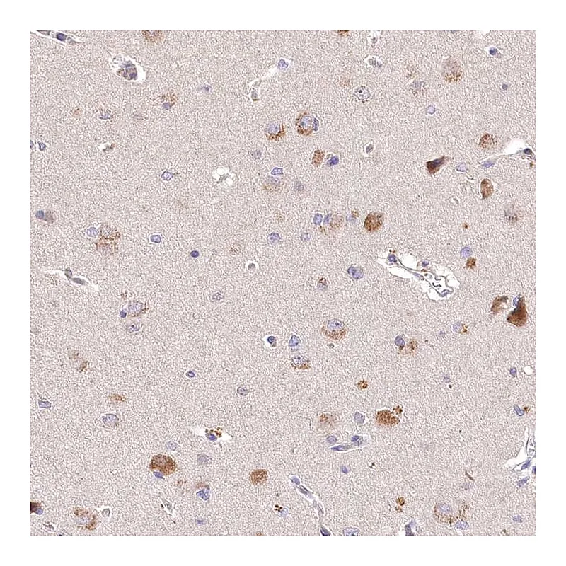 Atlas Antibodies Anti-PCYOX1L Antibody