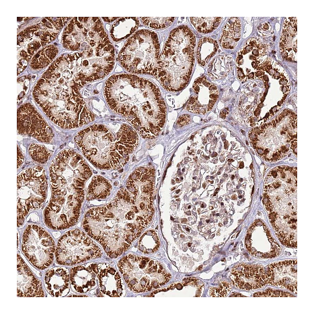 Atlas Antibodies Anti-PCTP Antibody