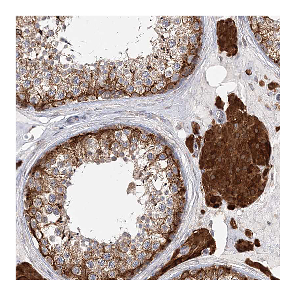 Atlas Antibodies Anti-PCYOX1L Antibody