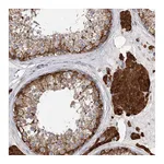 Atlas Antibodies Anti-PCYOX1L Antibody