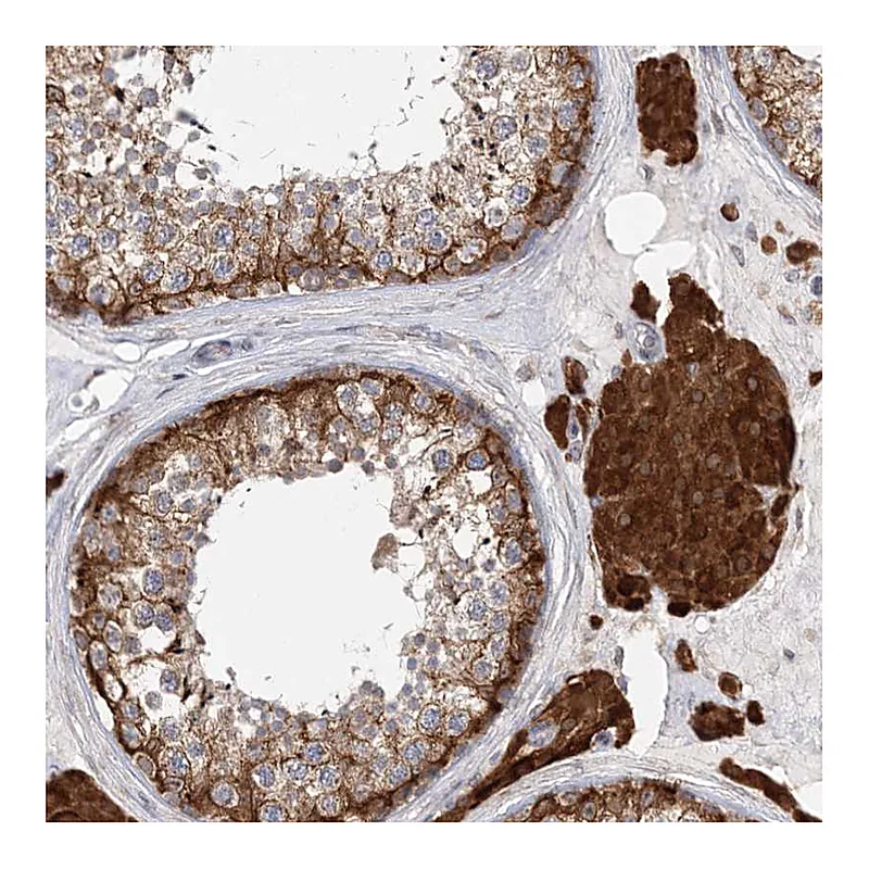 Atlas Antibodies Anti-PCYOX1L Antibody