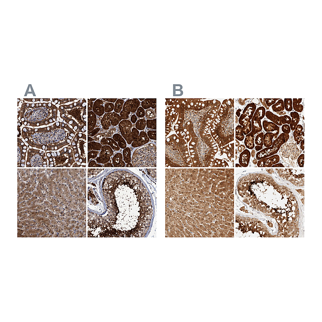 Atlas Antibodies Anti-PCYT2 Antibody