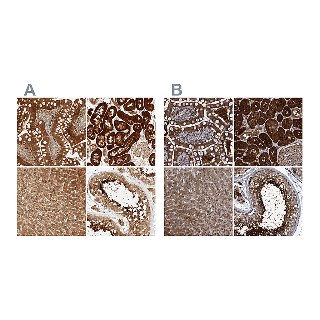 Atlas Antibodies Anti-PCYT2 Antibody