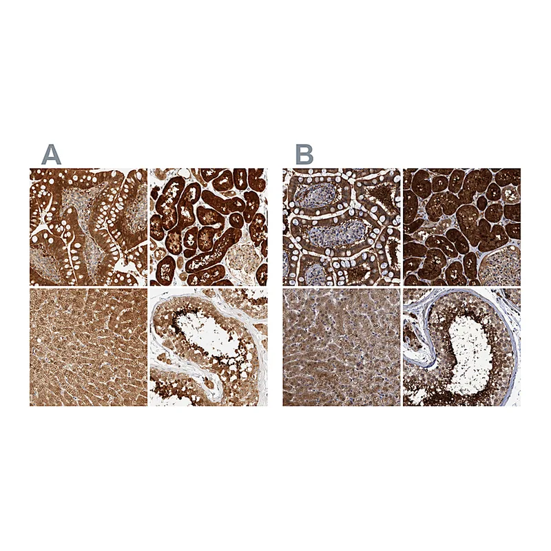 Atlas Antibodies Anti-PCYT2 Antibody