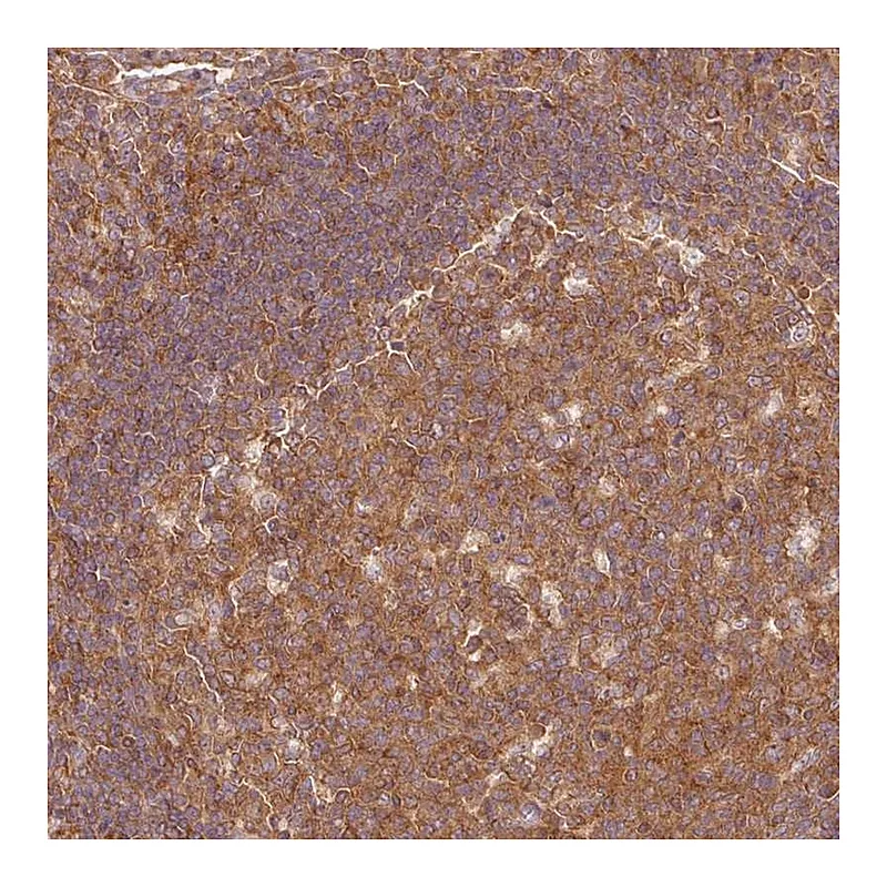 Atlas Antibodies Anti-PDAP1 Antibody