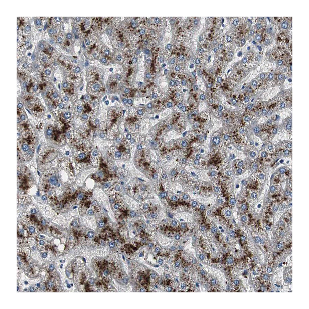 Atlas Antibodies Anti-PCYT1B Antibody
