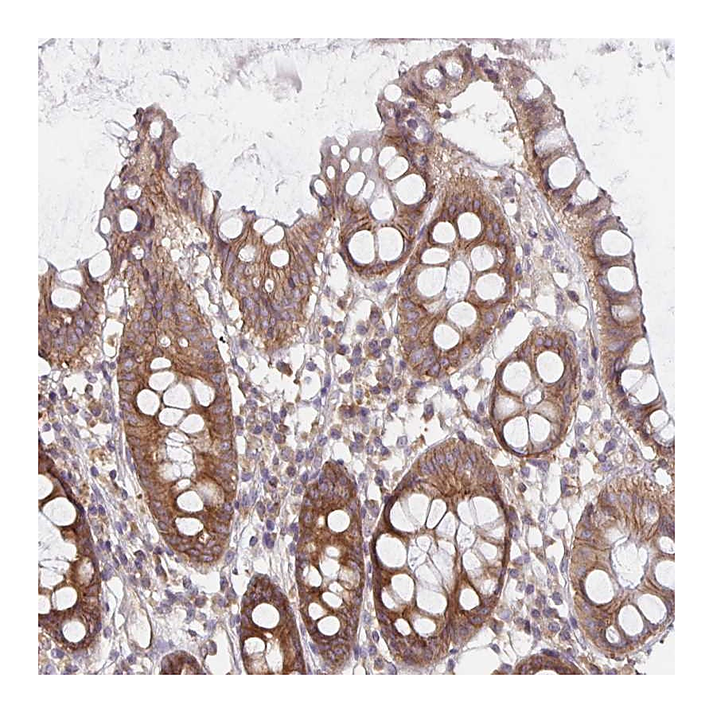 Atlas Antibodies Anti-PDAP1 Antibody