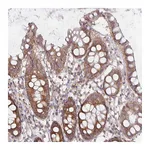 Atlas Antibodies Anti-PDAP1 Antibody