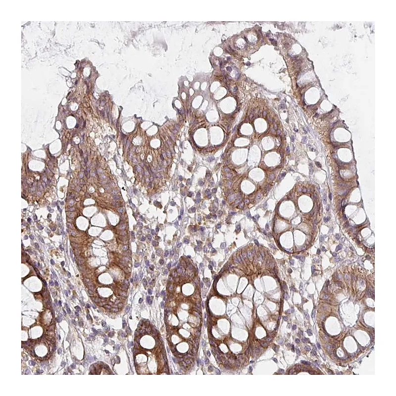 Atlas Antibodies Anti-PDAP1 Antibody