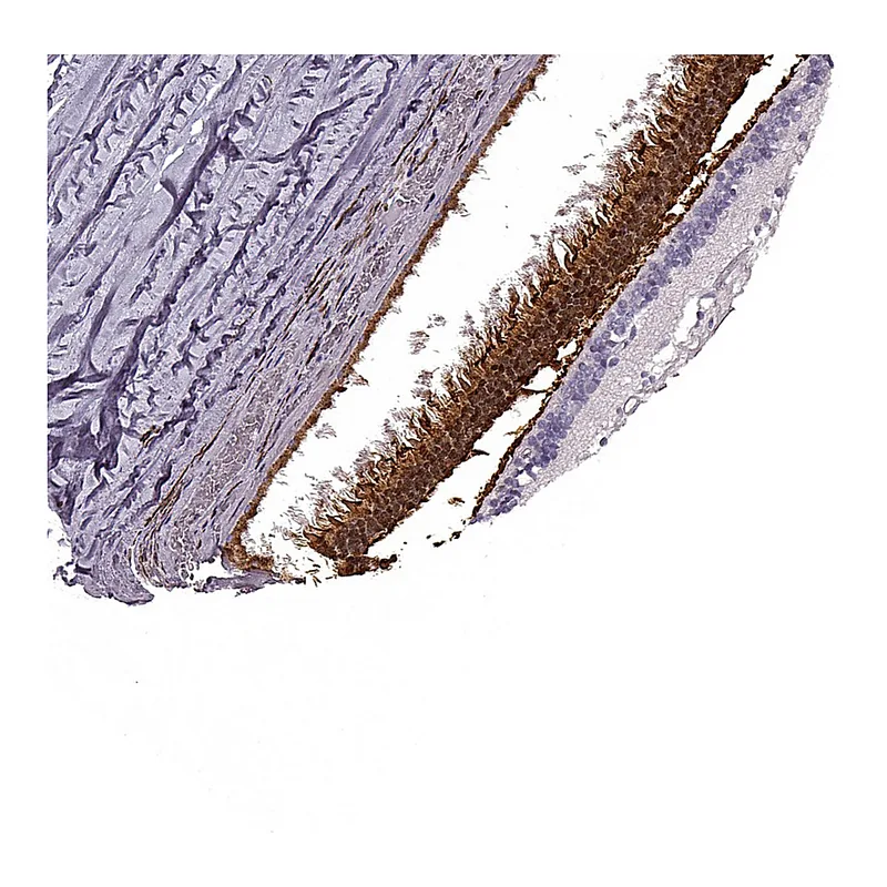 Atlas Antibodies Anti-PDC Antibody