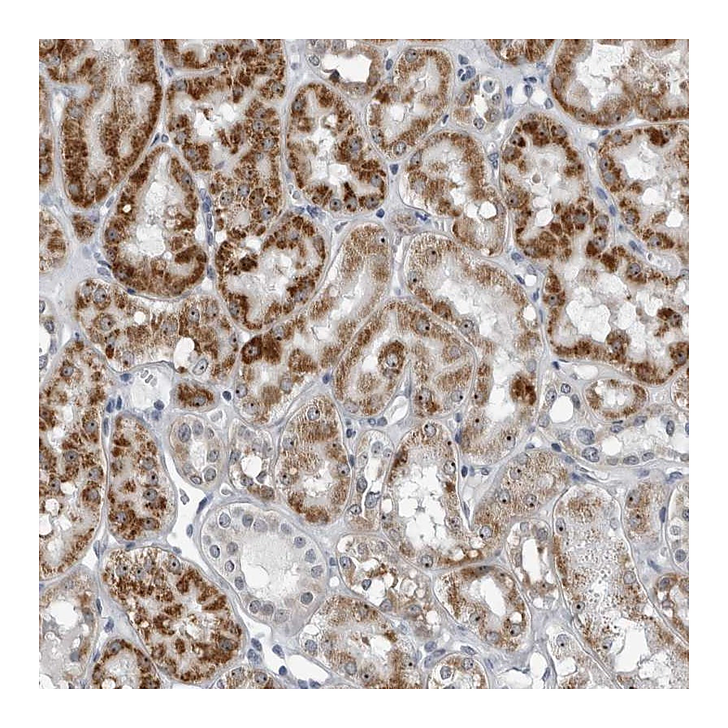 Atlas Antibodies Anti-PDCD11 Antibody