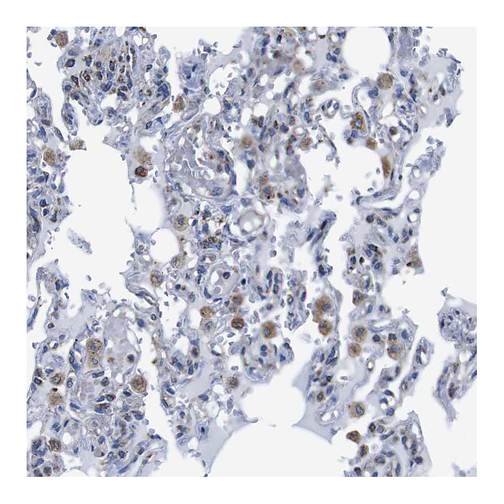 Atlas Antibodies Anti-PDCD1LG2 Antibody