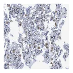 Atlas Antibodies Anti-PDCD1LG2 Antibody