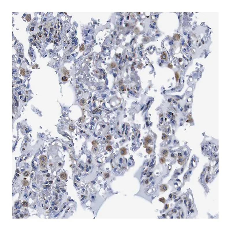 Atlas Antibodies Anti-PDCD1LG2 Antibody