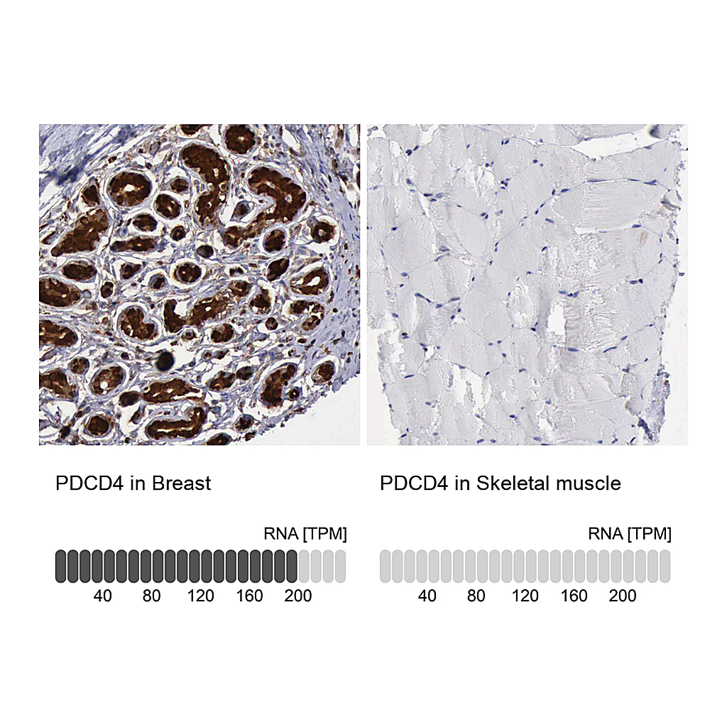 Atlas Antibodies Anti-PDCD4 Antibody