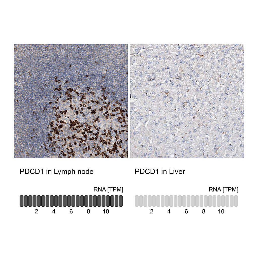 Atlas Antibodies Anti-PDCD1 Antibody