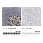 Atlas Antibodies Anti-PDCD1 Antibody