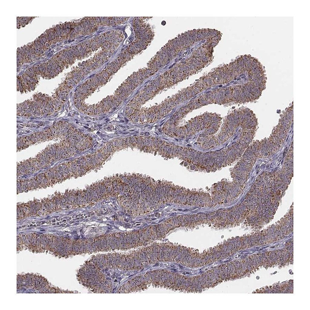 Atlas Antibodies Anti-PDCD2L Antibody