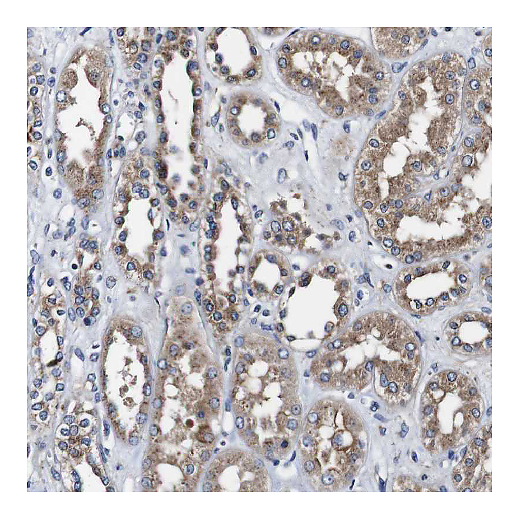 Atlas Antibodies Anti-PDCD6IP Antibody