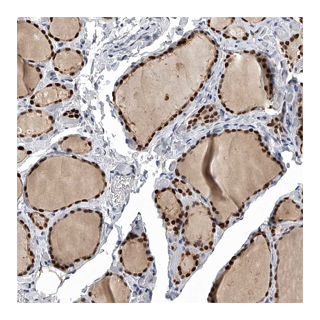Atlas Antibodies Anti-PDCD4 Antibody