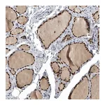 Atlas Antibodies Anti-PDCD4 Antibody