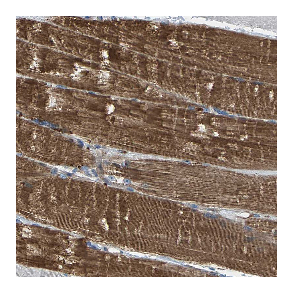 Atlas Antibodies Anti-PDCL Antibody
