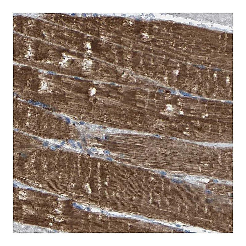 Atlas Antibodies Anti-PDCL Antibody