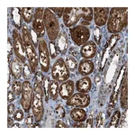Atlas Antibodies Anti-PDCL Antibody