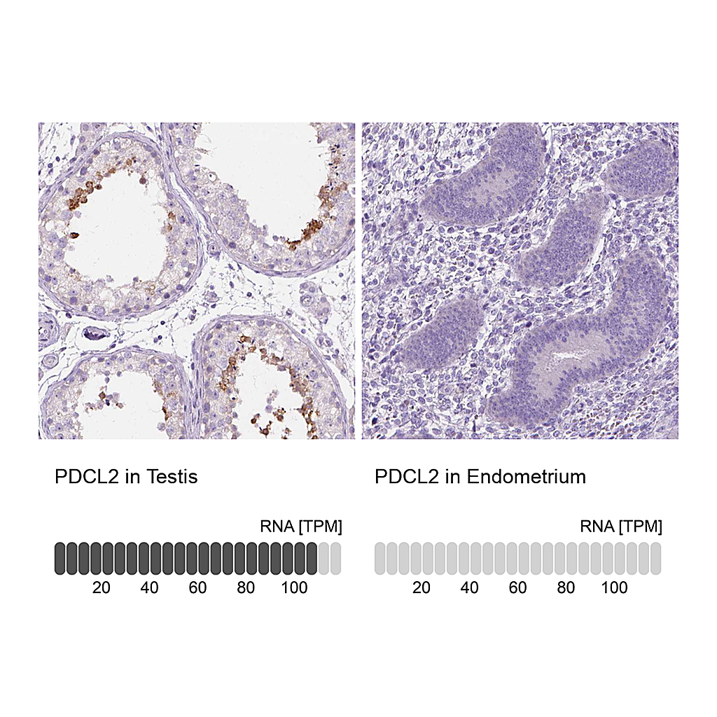 Atlas Antibodies Anti-PDCL2 Antibody