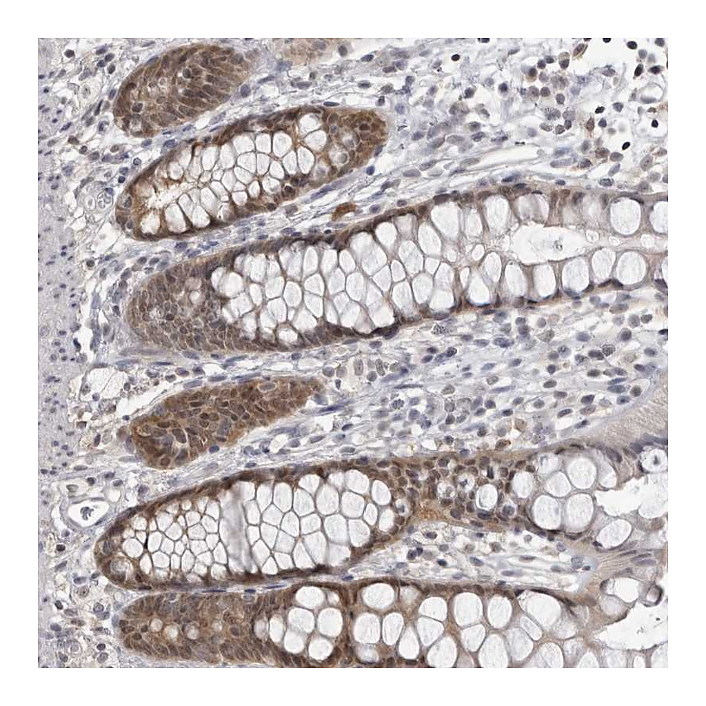 Atlas Antibodies Anti-PDCL3 Antibody