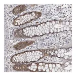 Atlas Antibodies Anti-PDCL3 Antibody