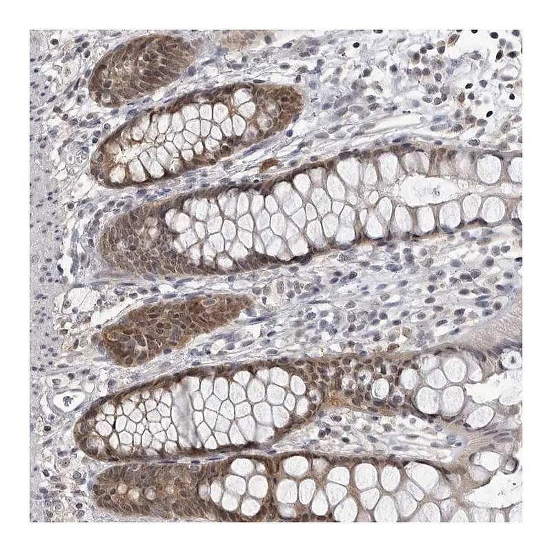 Atlas Antibodies Anti-PDCL3 Antibody