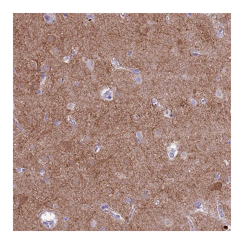 Atlas Antibodies Anti-PDE10A Antibody