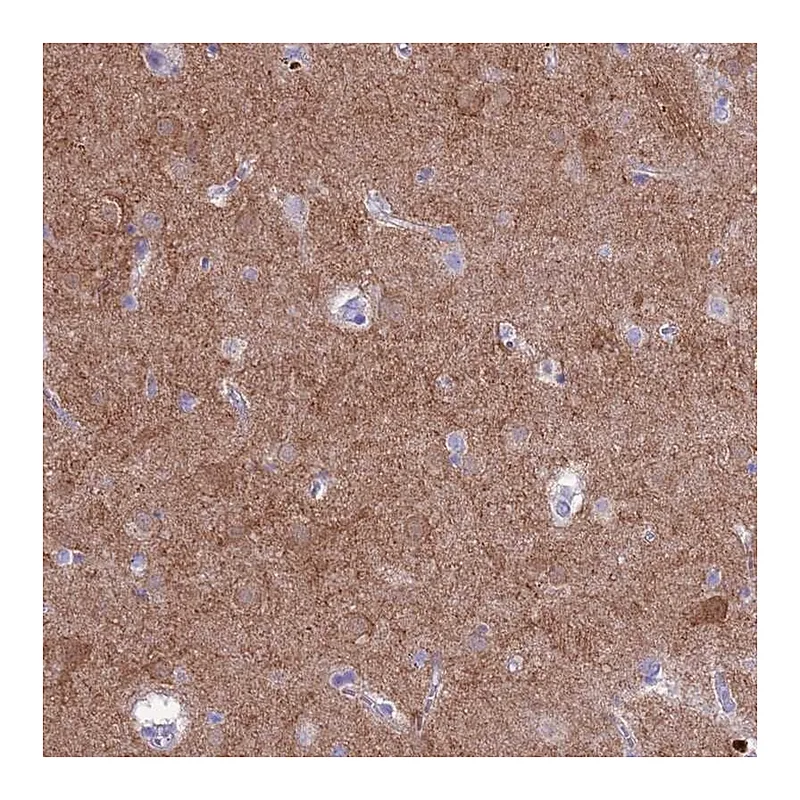 Atlas Antibodies Anti-PDE10A Antibody