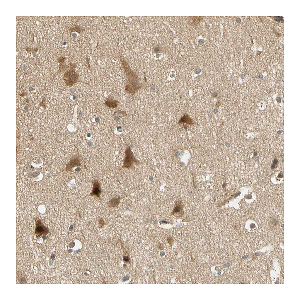 Atlas Antibodies Anti-PDDC1 Antibody