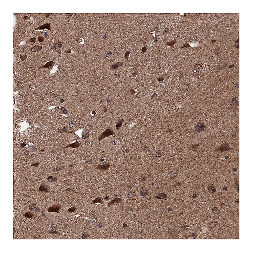 Atlas Antibodies Anti-PDE12 Antibody