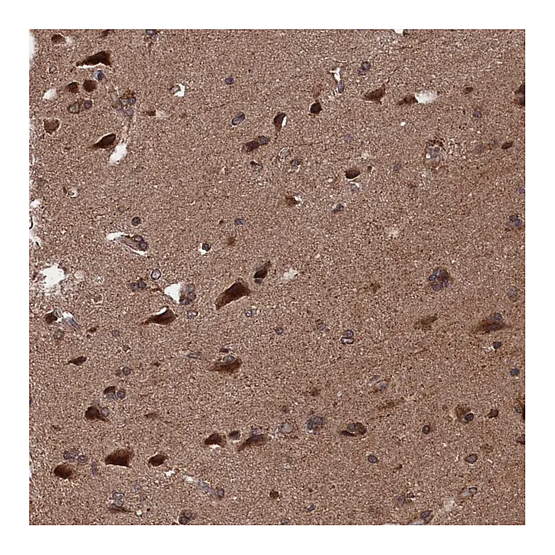 Atlas Antibodies Anti-PDE12 Antibody