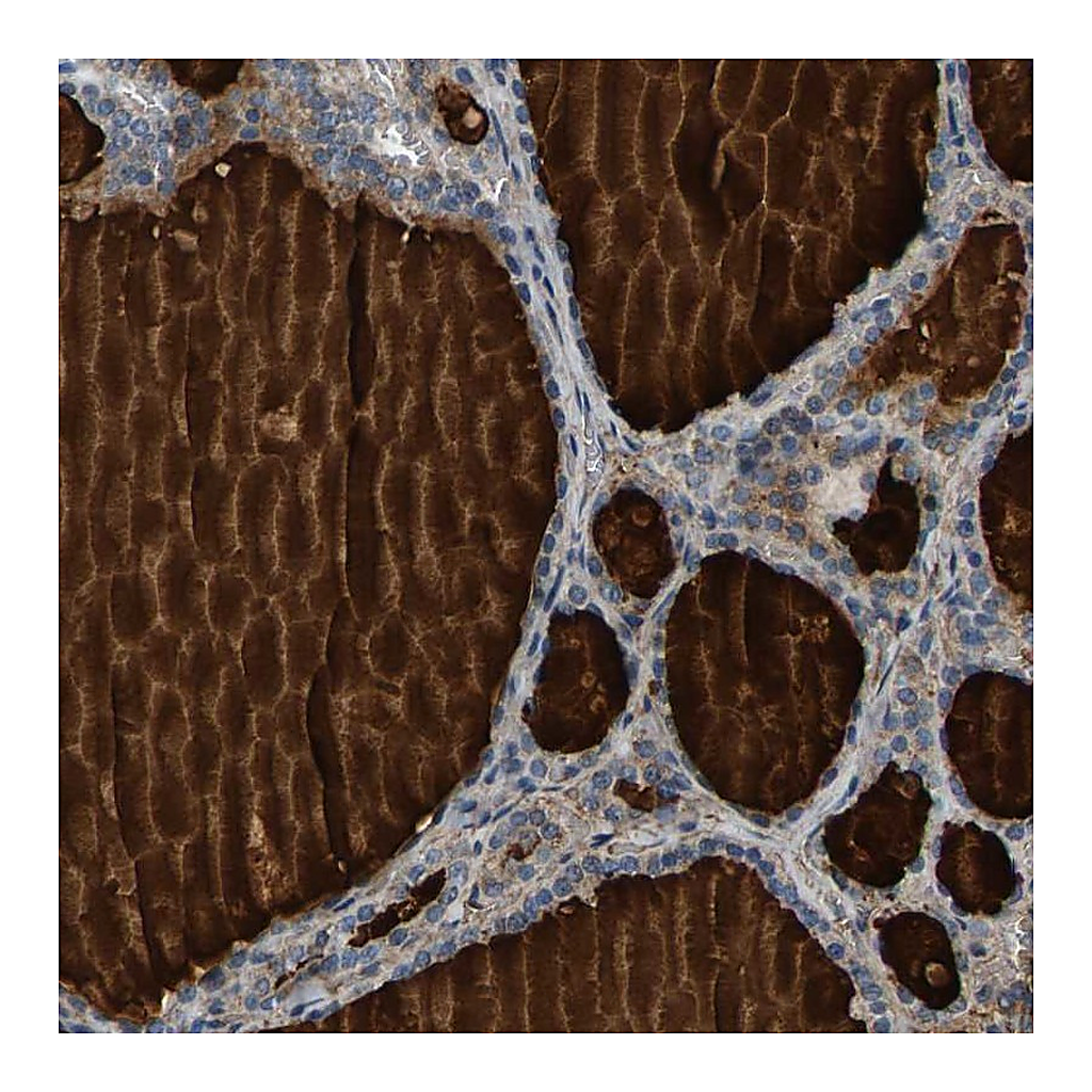 Atlas Antibodies Anti-PDE1A Antibody