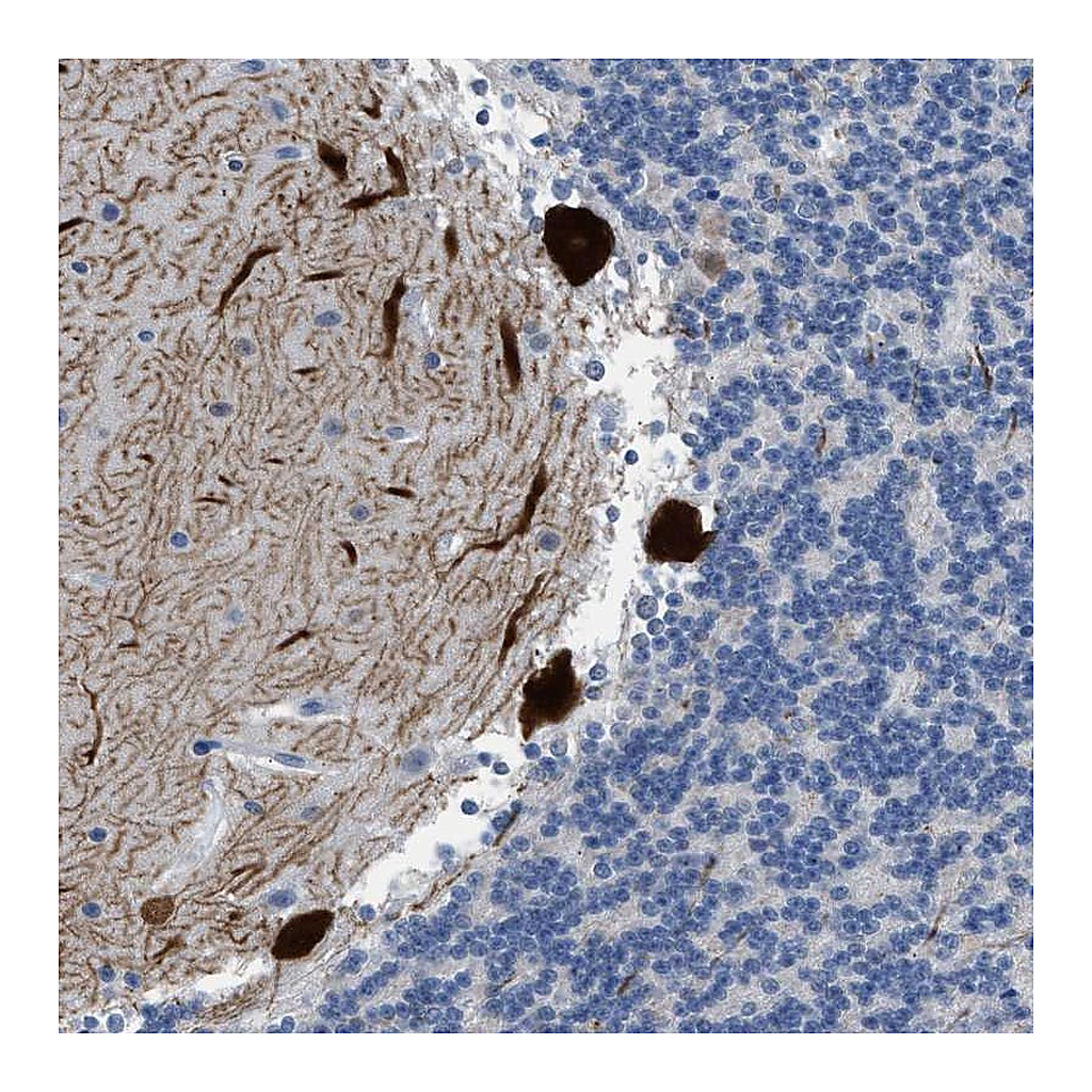 Atlas Antibodies Anti-PDE1B Antibody