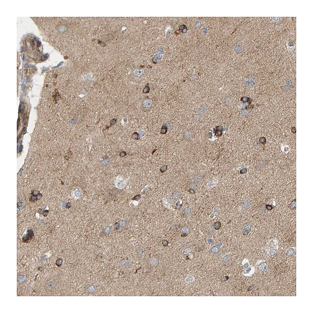 Atlas Antibodies Anti-PDE1C Antibody
