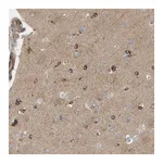 Atlas Antibodies Anti-PDE1C Antibody