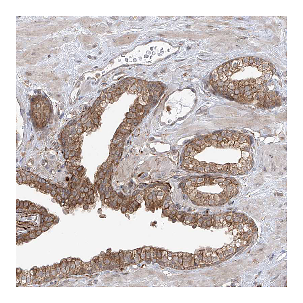 Atlas Antibodies Anti-PDE11A Antibody