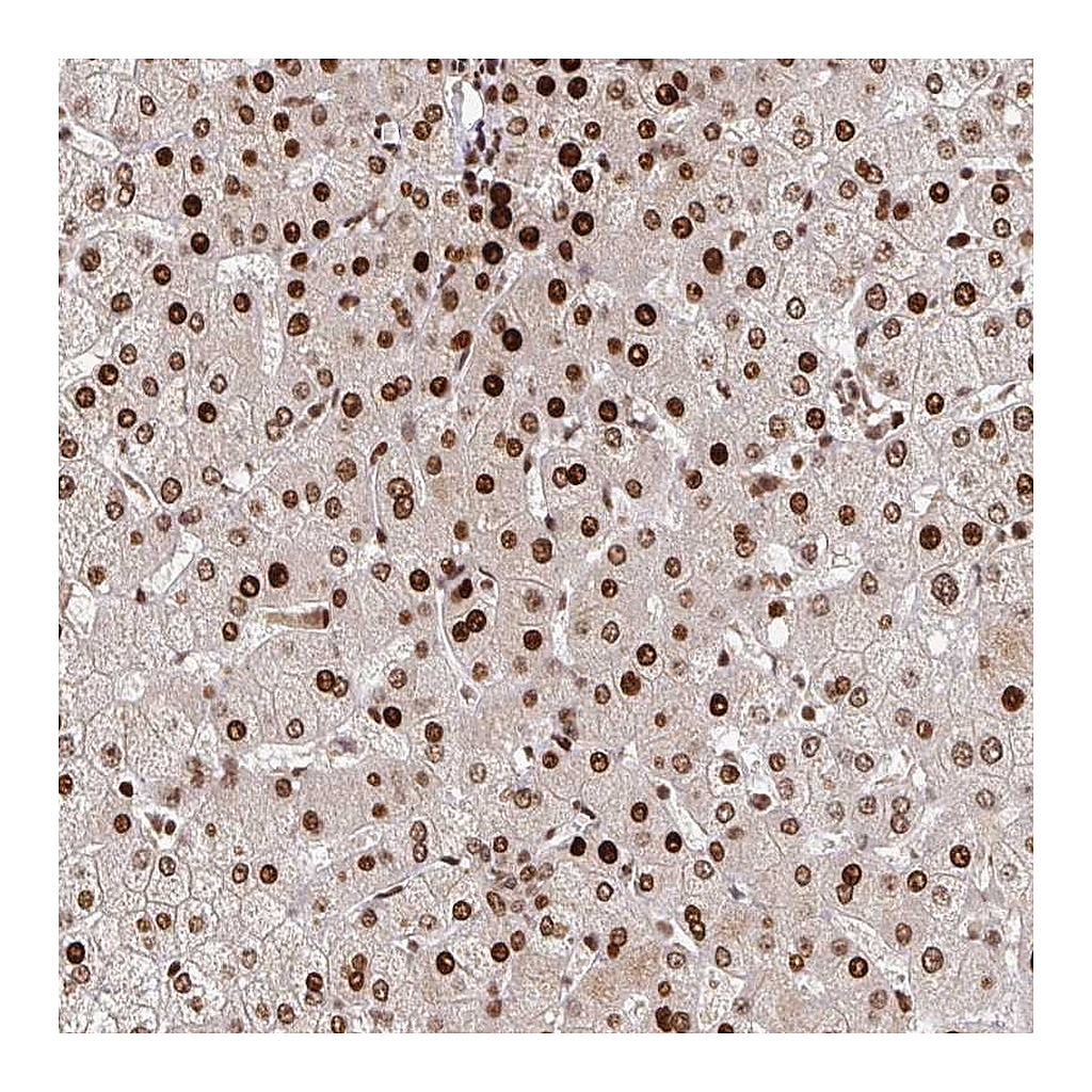 Atlas Antibodies Anti-PDE1C Antibody