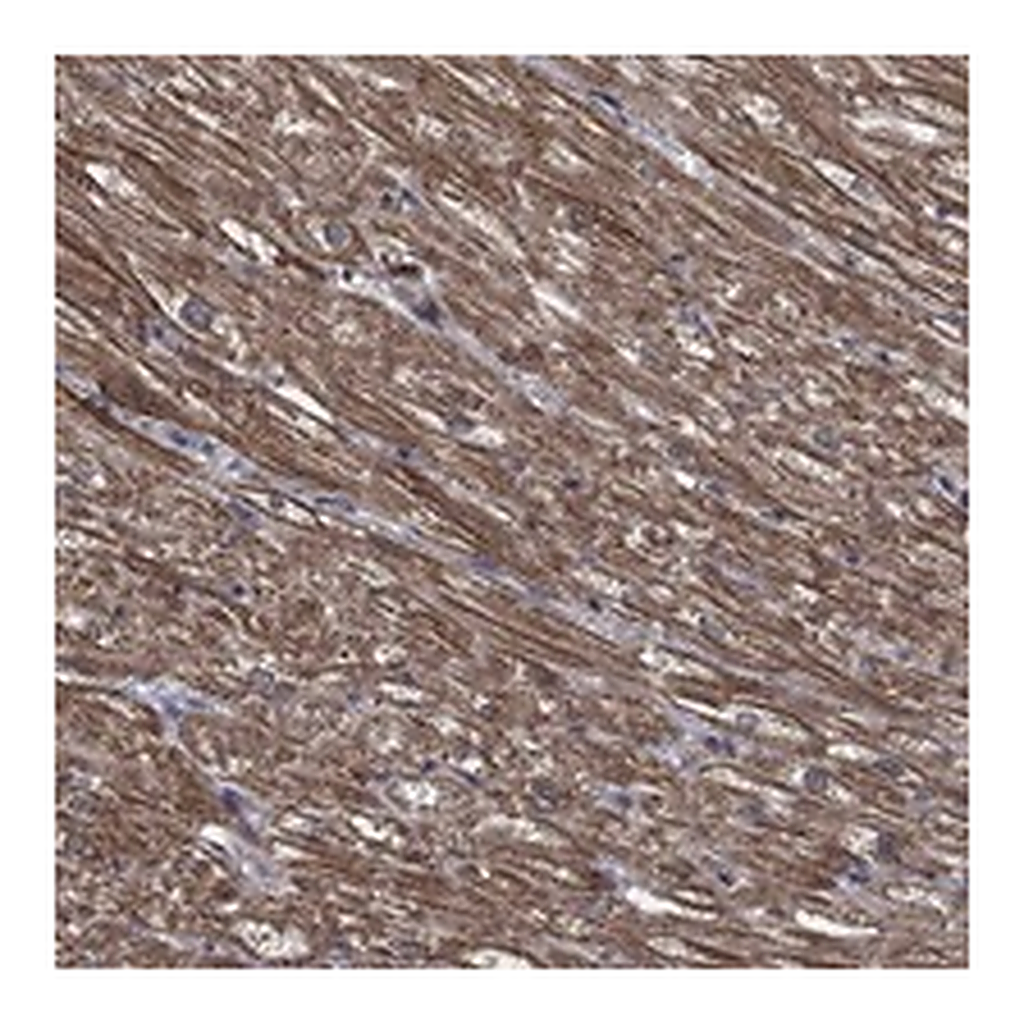 Atlas Antibodies Anti-PDE3A Antibody