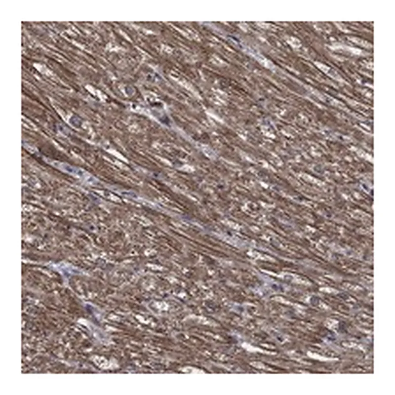 Atlas Antibodies Anti-PDE3A Antibody