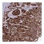 Atlas Antibodies Anti-PDE4A Antibody